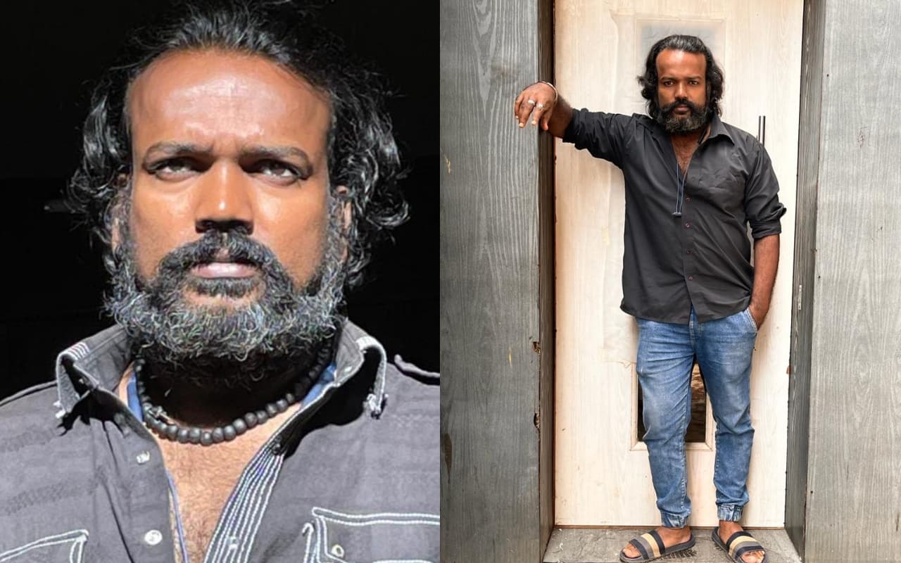 कुत्ते के काटने को नहीं लिया गंभीरता से तो हो सकती है मौत, बिहार में आज से नि:शुल्क मिलेगा रेबीजरोधी टीका