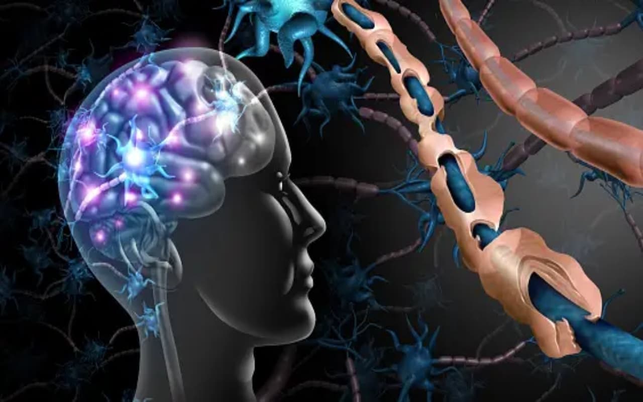 Life pressure से बढ़ रहा मल्टीपल स्केलेरोसिस का खतरा, संकेतों को समझें हो जाएं सावधान