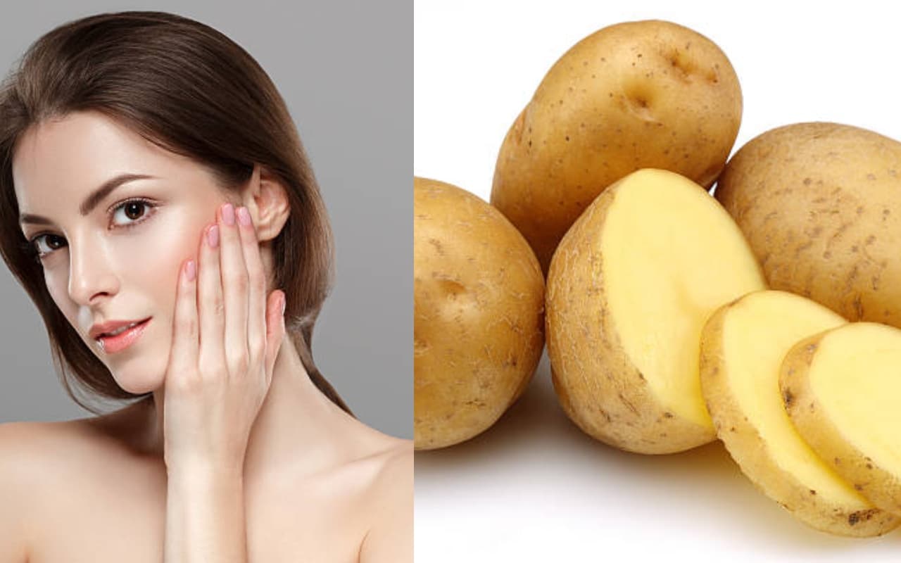 आपकी ब्यूटी का बॉडीगार्ड है आलू , दाग धब्बों और झाइयों पर दिखाता है मैजिकल असर