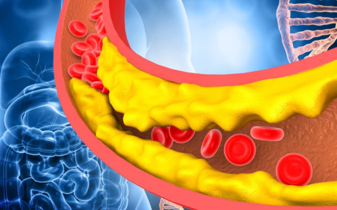Cholesterol Control: बढ़ती उम्र के साथ बढ़ सकता है कोलेस्ट्रॉल का खतरा, वक्त पर करिए कंट्रोल