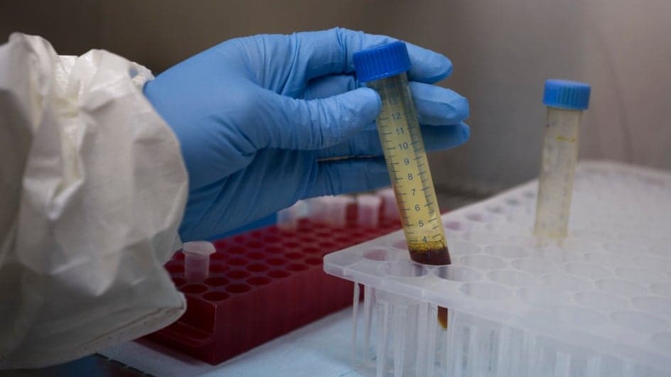 कोरोना की जांच में बंगाल काफी पीछे, नहीं आ पा रहे सही आंकड़े