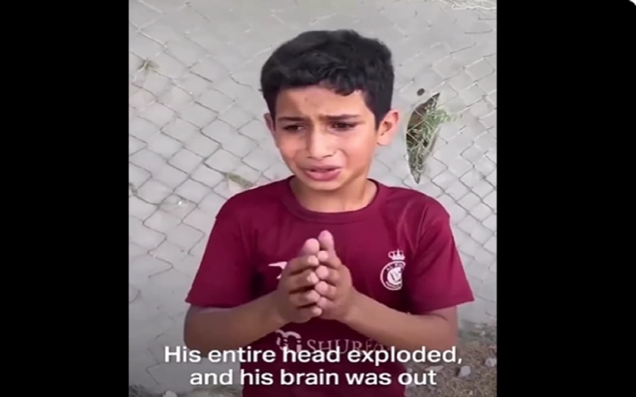Video : बम गिरा और उसका ब्रेन बाहर आ गया,  एक फिलिस्तीनी बच्चे ने रोते हुए बताई रूह कंपाने वाली सच्चाई...