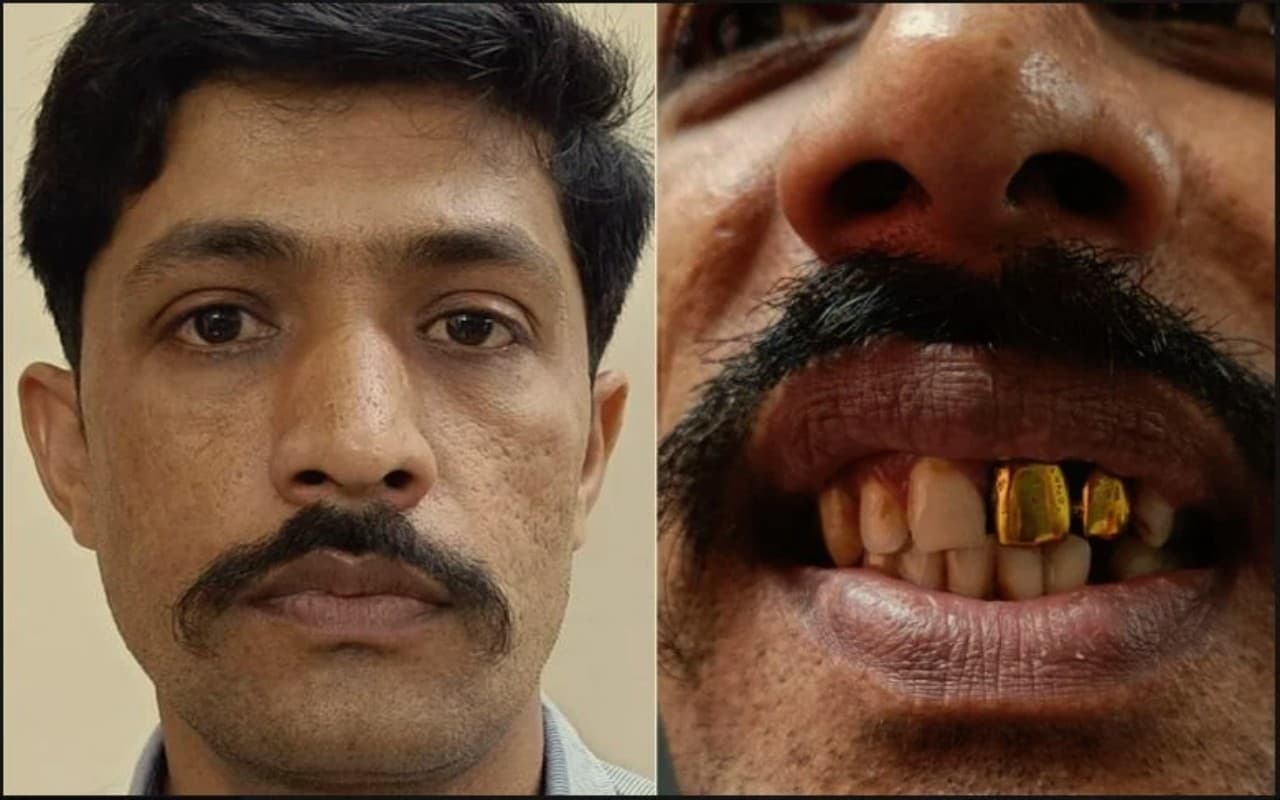 15 वर्षों से फरार अपराधी को पुलिस ने दबोचा, सोने के दांतों की वजह से हुई पहचान