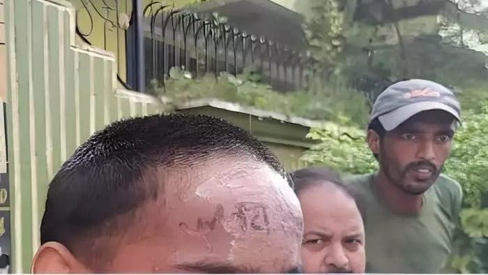 बरेली में शर्मनाक हरकत, मंदबुद्धि युवक के माथे पर ममेरे भाई ने गोदा 'जय भोलेनाथ', जानें फिर क्या हुआ...