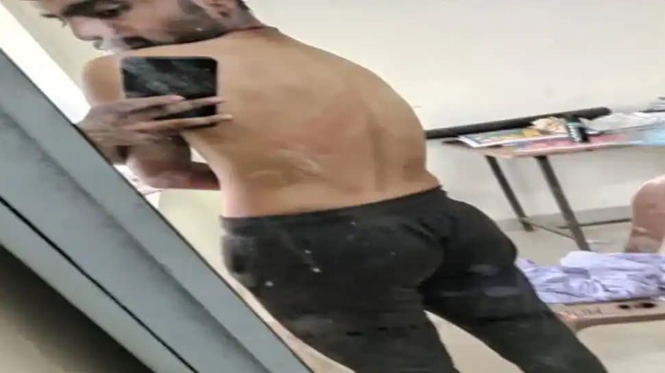 लखनऊ के सरस्वती डेंटल कॉलेज में झारखंड के छात्र के साथ रैगिंग, मारपीट कर सोने की चेन लूट ले गए सीनियर्स