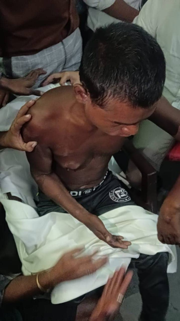 Kanpur News: कानपुर में युवक को बंधक बनाकर आंख फोड़ी, हाथ-पैर तोड़े, मंगवाई भीख, एफआईआर दर्ज