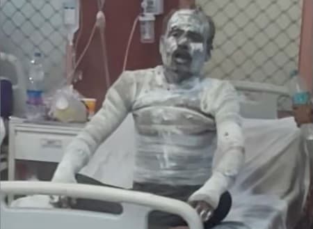 Lucknow News: पूर्व संविदा कर्मी के आत्मदाह कांड में पुलिस ने लिया एक्शन, मकान मालिक समेत अन्य पर केस