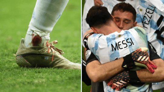 पैर से टपक रहा था खून फिर भी डटे रहे मेसी, टीम को फाइनल में पहुंचा कर लिया दम, फैंस ने बहादुरी को किया सलाम