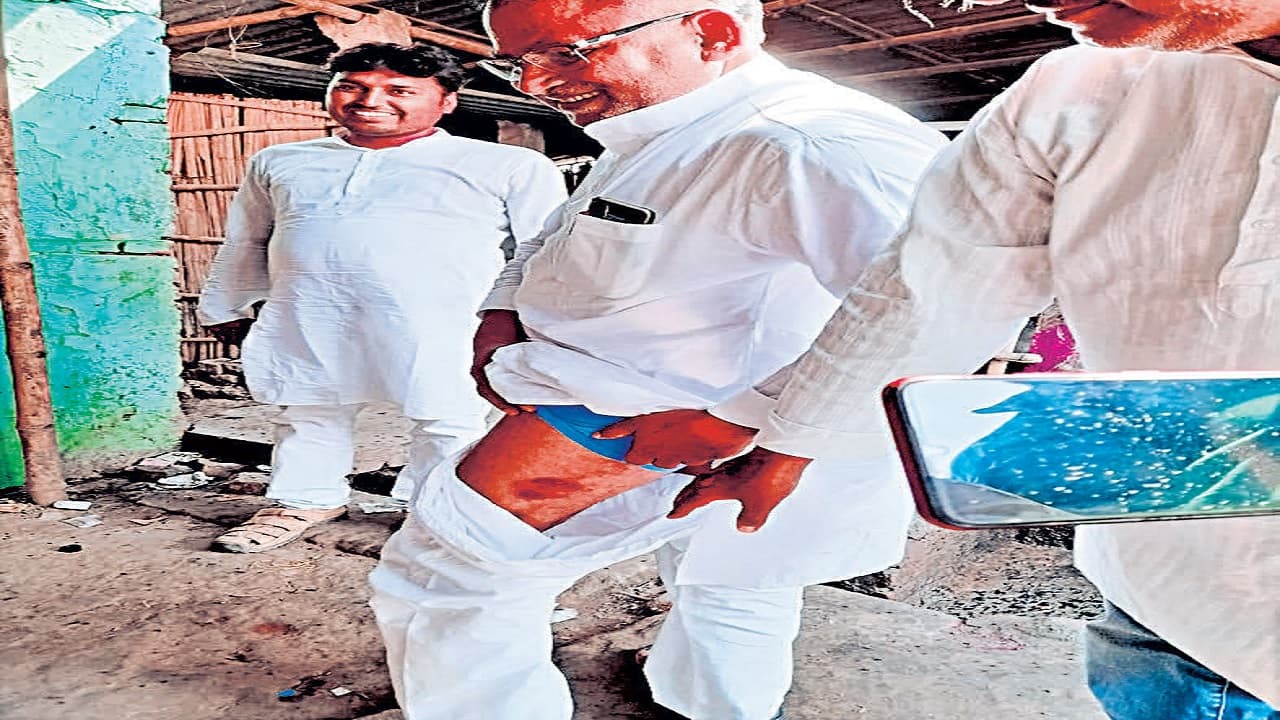 बेतिया में सिकटा विधायक वीरेंद्र प्रसाद गुप्ता पर भी बरसे पुलिस के डंडे, भीड़ पर काबू पाने गयी थी पुलिस