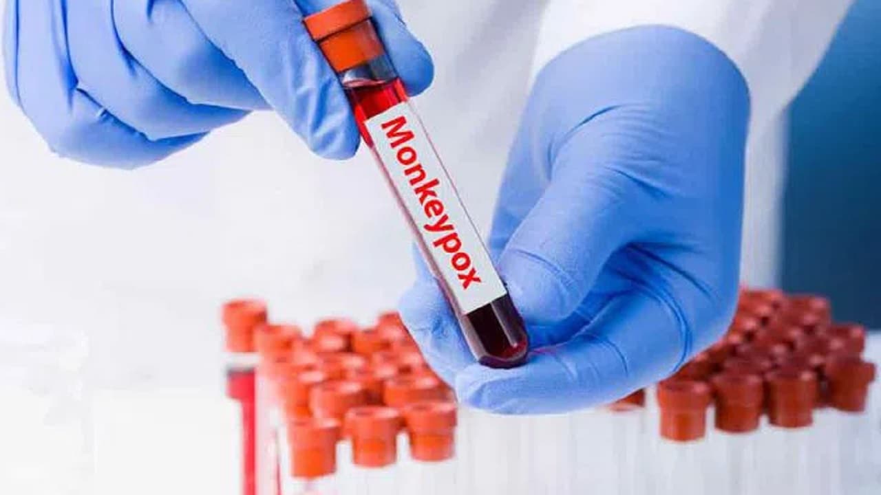 Hyderabad: सीवेज सर्विलांस सिस्‍टम से मंकीपॉक्स और डेंगू के मामलों को ट्रैक में मिलेगी मदद, पढ़ें रिपोर्ट