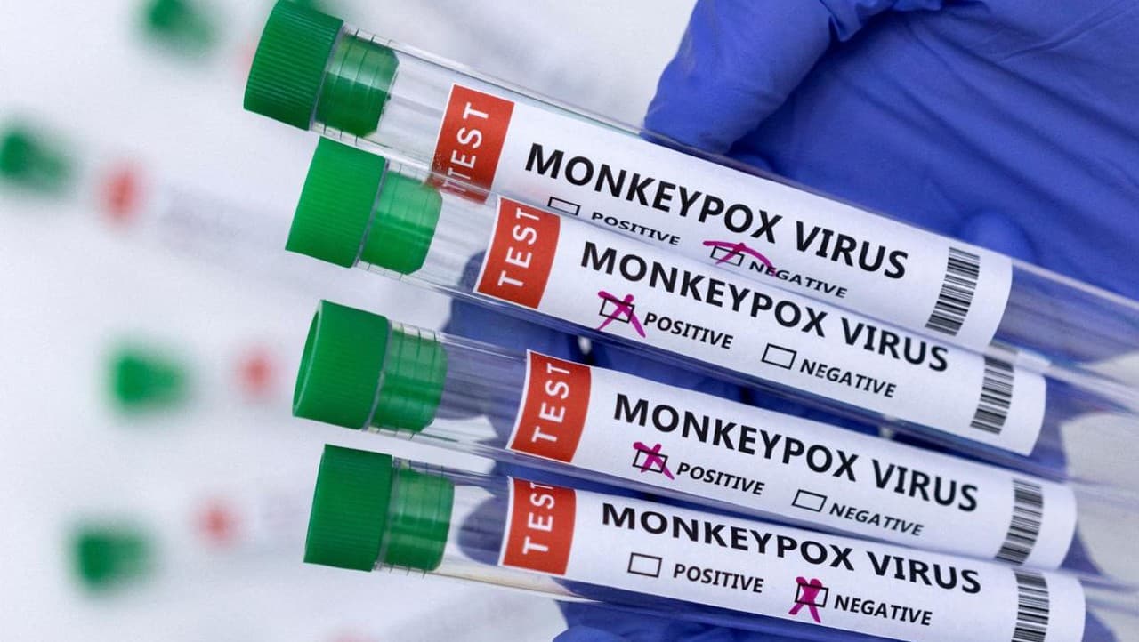 Monkeypox से बचने के लिए तुरंत डाउनलोड करें ये APP, जानिए कैसे फैलती है ये बीमारी, इन उपायों से करें बचाव