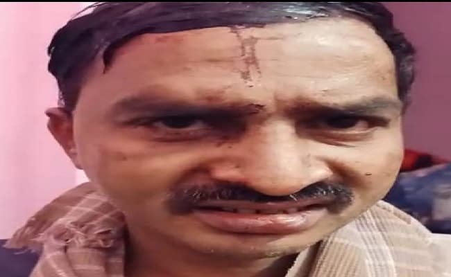 Bihar Crime News Update : शराब की नशे में पुलिस जवान ने सरकारी पिस्टल से पत्नी पर चलायी गोली, खुद हुआ घायल