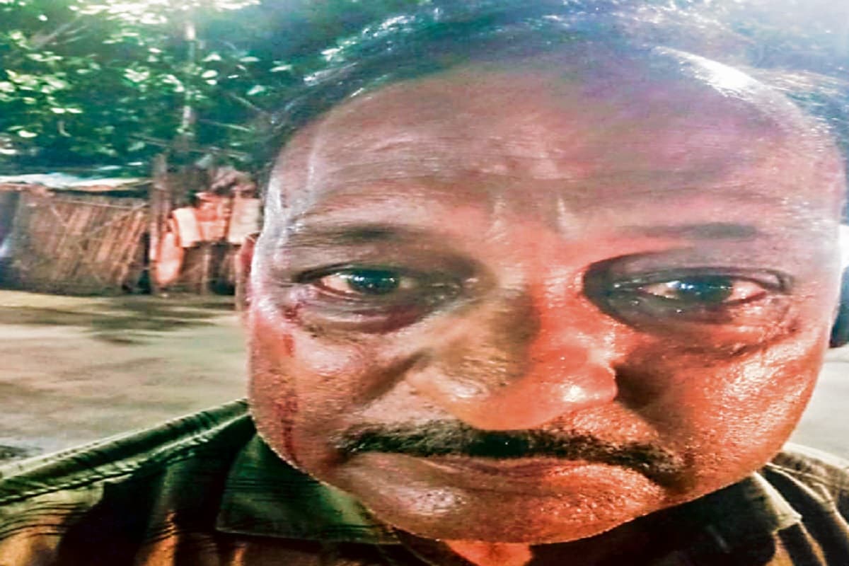 अजीबो गरीब बीमारी: आंखों से आंसू की जगह बहता है खून, डॉक्टर भी नहीं पता कर पा रहे वजह