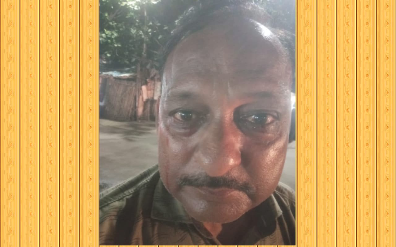 चाईबासा के नरेश सुल्तानिया की आंखों से 17 साल से बह रहा है खून, यकीन न हो तो यहां देखिए