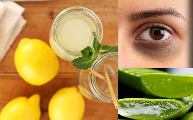 बेटी की आंखों के नीचे काले घेरे से हैं परेशान तो इन 6 चीजों में करना होगा सुधार