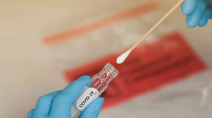 राज्य के सिर्फ छह निजी अस्पतालों को मिली है रैपिड एंटीजन टेस्ट की अनुमति