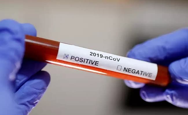 बिहार में कोरोना का नया वैरिएंट BA12 मिलने से स्वास्थ विभाग हुआ सतर्क, जीनोम सिक्वेंसिंग में हुई पुष्टि
