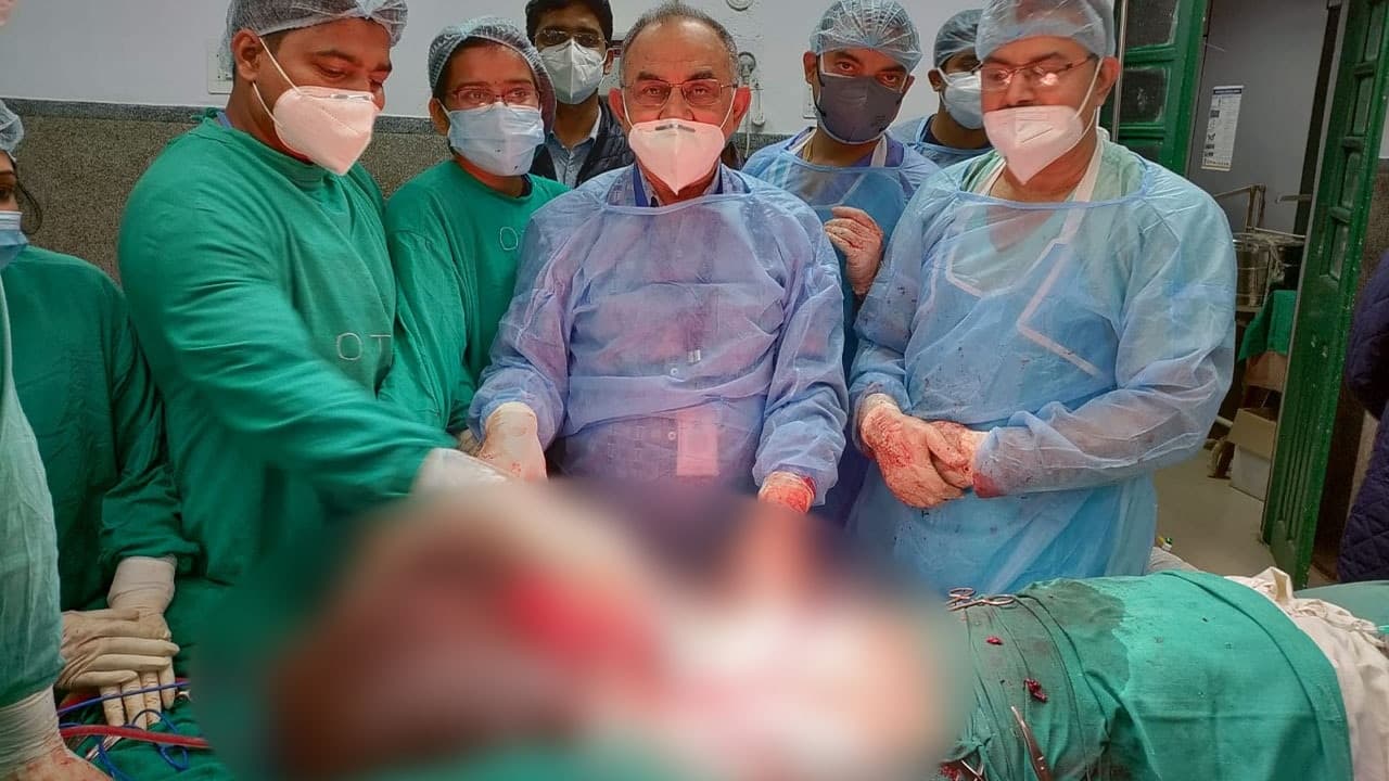 Bihar News: 30 किलो के हाइड्रोसील की समस्या से जूझ रहा था मरीज, PMCH में डॉक्टरों ने किया ऑपरेशन