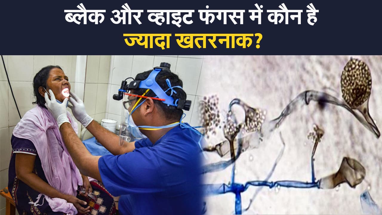कोरोना के बाद अब फंगस अटैक, जानिए ब्लैक या व्हाइट फंगस में कौन है ज्यादा खतरनाक?