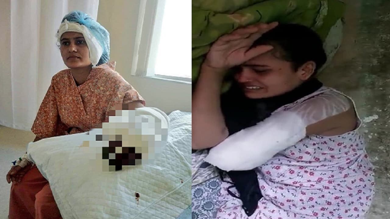 पटना में कान का इलाज कराने गयी युवती को कटवाना पड़ा हाथ, अस्पताल की एक लापरवाही से जिंदगी बनी बोझ