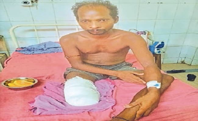 दलालों के चक्कर में युवक का कटा पैर, JLNMCH से आयुष्मान अस्पताल आना पड़ा महंगा