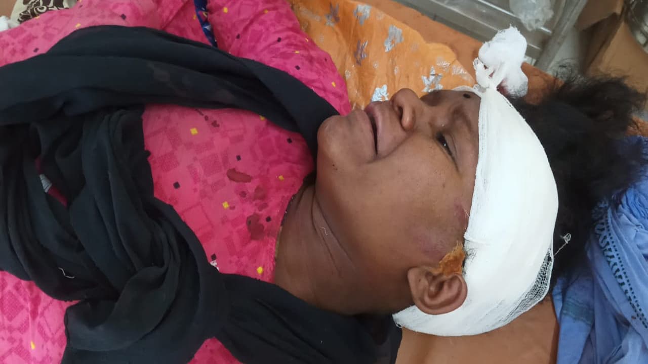 झारखंड के चाईबासा में तेज रफ्तार वाहन ने 2 साइकिल सवार को रौंदा, युवती की मौत, दो गंभीर रूप से घायल