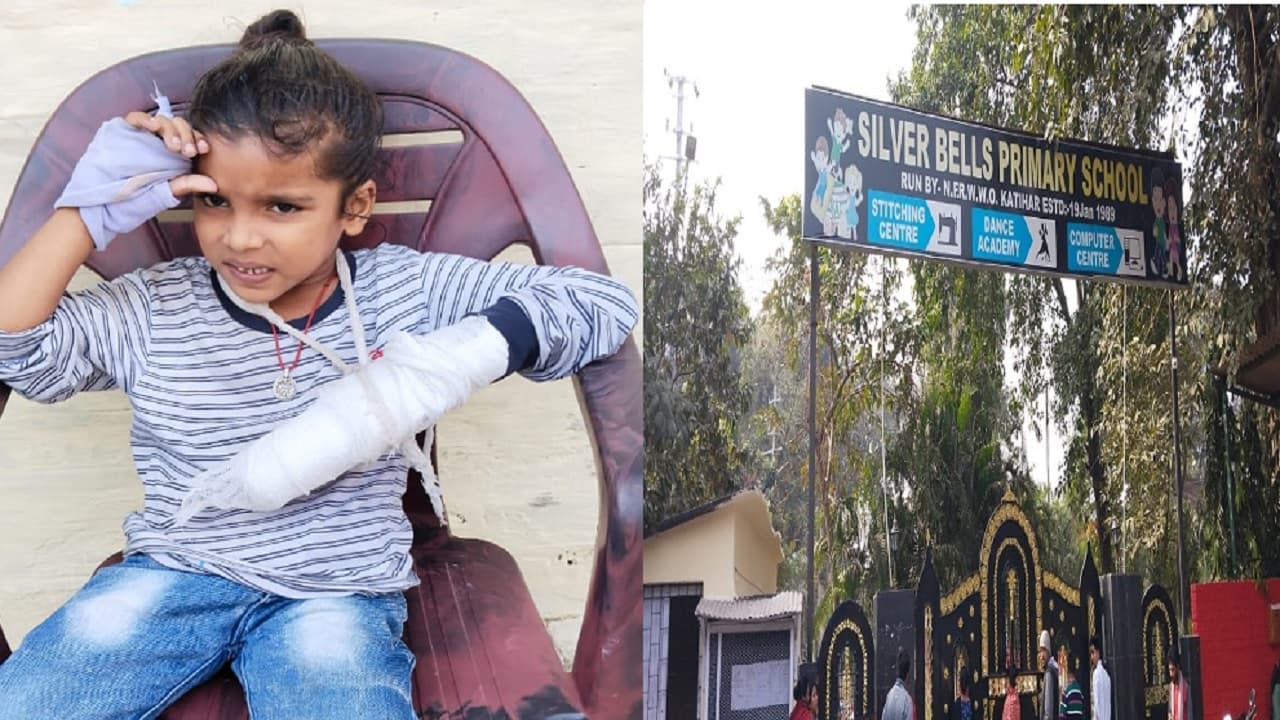 बिहार: कटिहार के स्कूल में मासूम की उंगली कटी, शिक्षिका ने आनन-फानन में डस्टबिन में फेंक दिया, फिर…