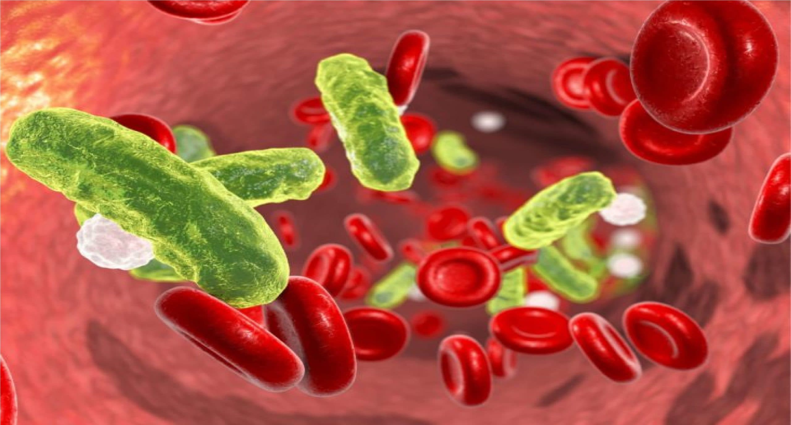 क्यों जानलेवा है सेप्टिक शॉक जिससे ग्रसित हैं पूर्व राष्ट्रपति, इस दौरान क्यों सभी अंगों को पहुंचने लगता है नुकसान