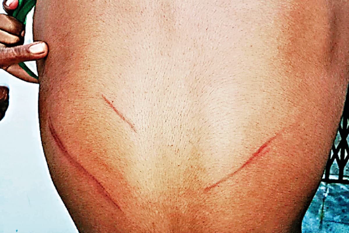 नेतरहाट आवासीय विद्यालय के शिक्षक ने छात्र को पीटा, अभिभावक ने थाने में दिया आवेदन, जानें पूरा मामला