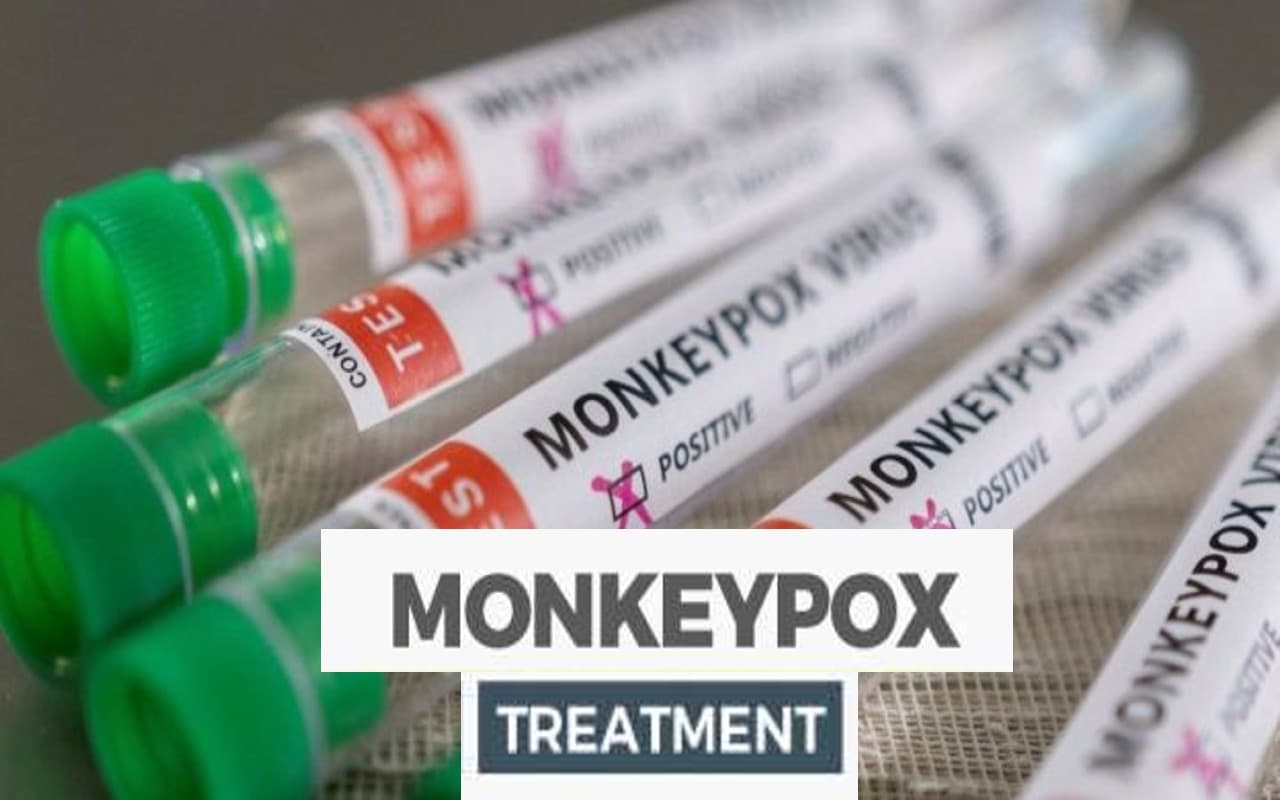 Monkeypox के उपचार के लिए एंटीवायरल दवा ‘टेकोविरिमैट’ प्रभावी, अध्ययन से ये बात आई सामने