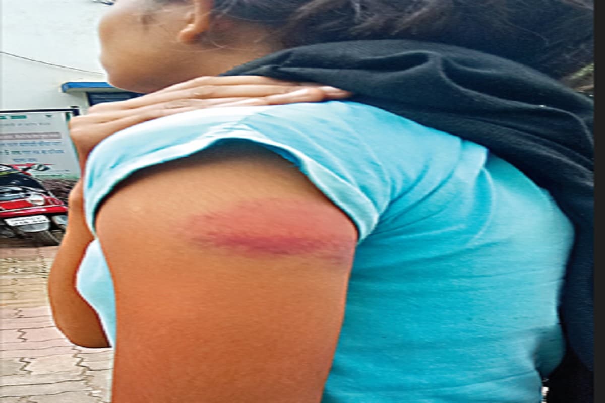 स्कूल में अनुपस्थित रहने पर शिक्षकों ने की पिटाई, छात्रा ने की आत्महत्या की कोशिश