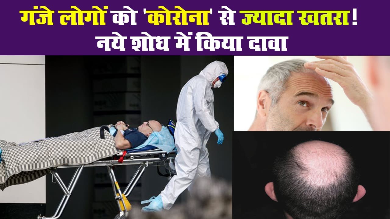 गंजे लोगों को 'कोरोना' से ज्यादा खतरा! नये शोध में किया दावा