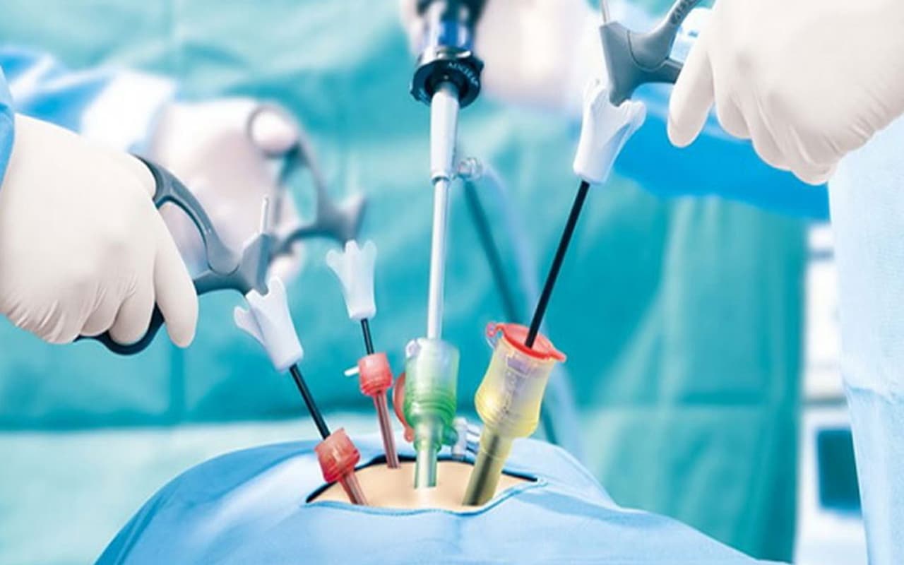 बांझपन के उपचार में लेप्रोस्कोपिक सर्जरी कारगर, जानें क्या कहते हैं एक्सपर्ट