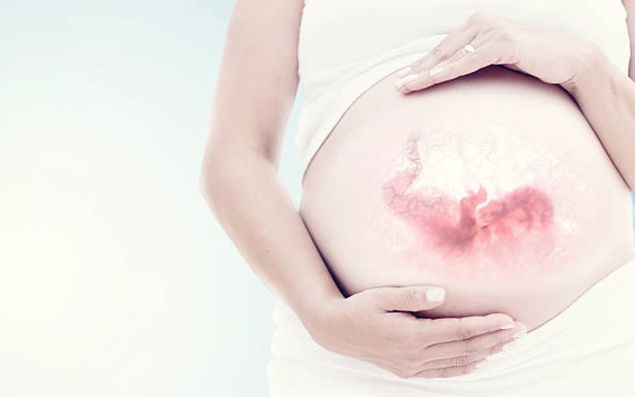 National Safe Motherhood Day 2023: जानें क्यों मनाया जाता है ये खास दिन, इन तरीकों से मातृत्व को रखें सुरक्षित