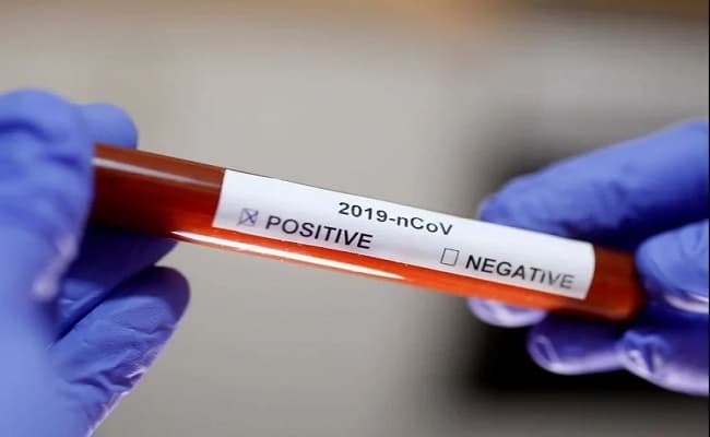 Coronavirus Bihar Latest Update : बिहार में निजी अस्पताल कोविड-19 के लक्षणों वाले रोगियों को नहीं कर रहे हैं भर्ती : एनटीपीसी