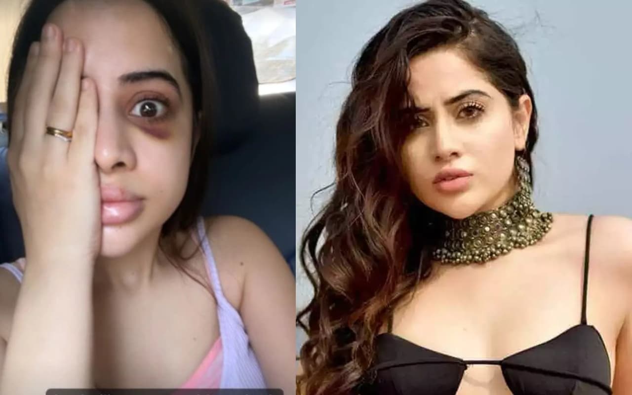 उर्फी जावेद को किसने पीटा? आंख के नीचे काले निशान देख फैंस हुए परेशान, वायरल हो रही ये तसवीर