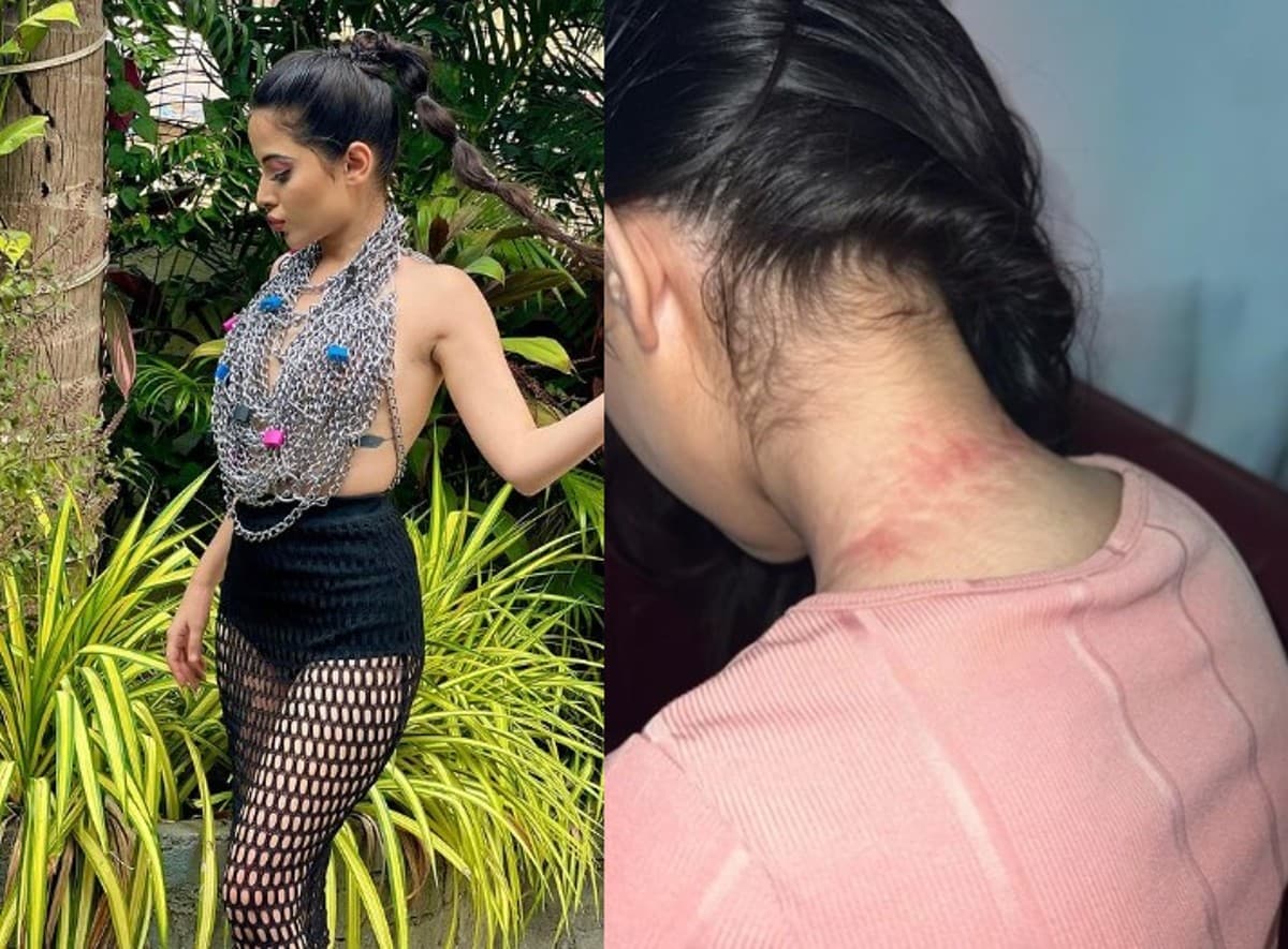 Uorfi Javed Photos:कपड़ों के साथ एक्सपेरिमेंट करने के चक्कर में उर्फी जावेद का हुआ बुरा हाल,देखें तसवीरें