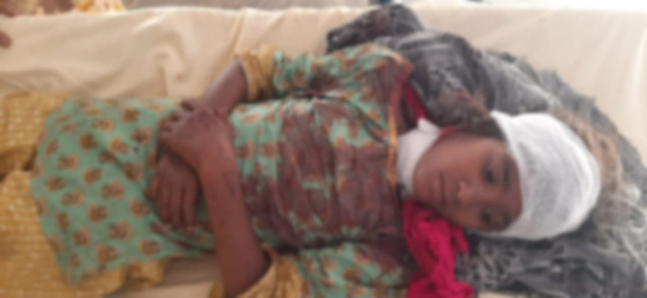 बरेलीः आदमखोर कुत्तों का छात्रा पर हमला, राहगीरों ने बचाई बच्ची की जान, अब तक 11 की मौत