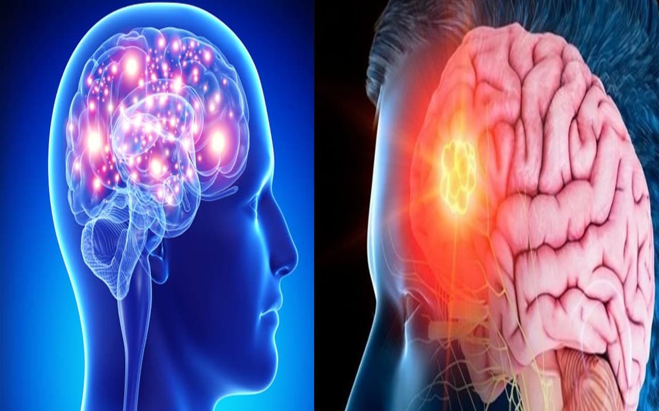 Prabhat Khabar Special: अच्छी नींद व स्वस्थ आहार से मस्तिष्क रहेगा सेहतमंद