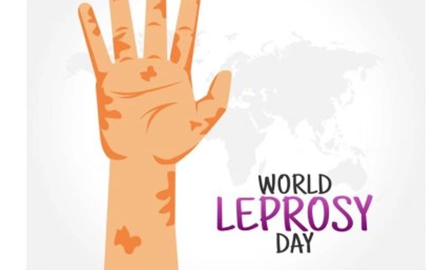 World Leprosy Day 2023: कुष्ठ रोग का उपचार संभव, जी सकते हैं सामान्य जिंदगी, जानें क्या है इसका इलाज
