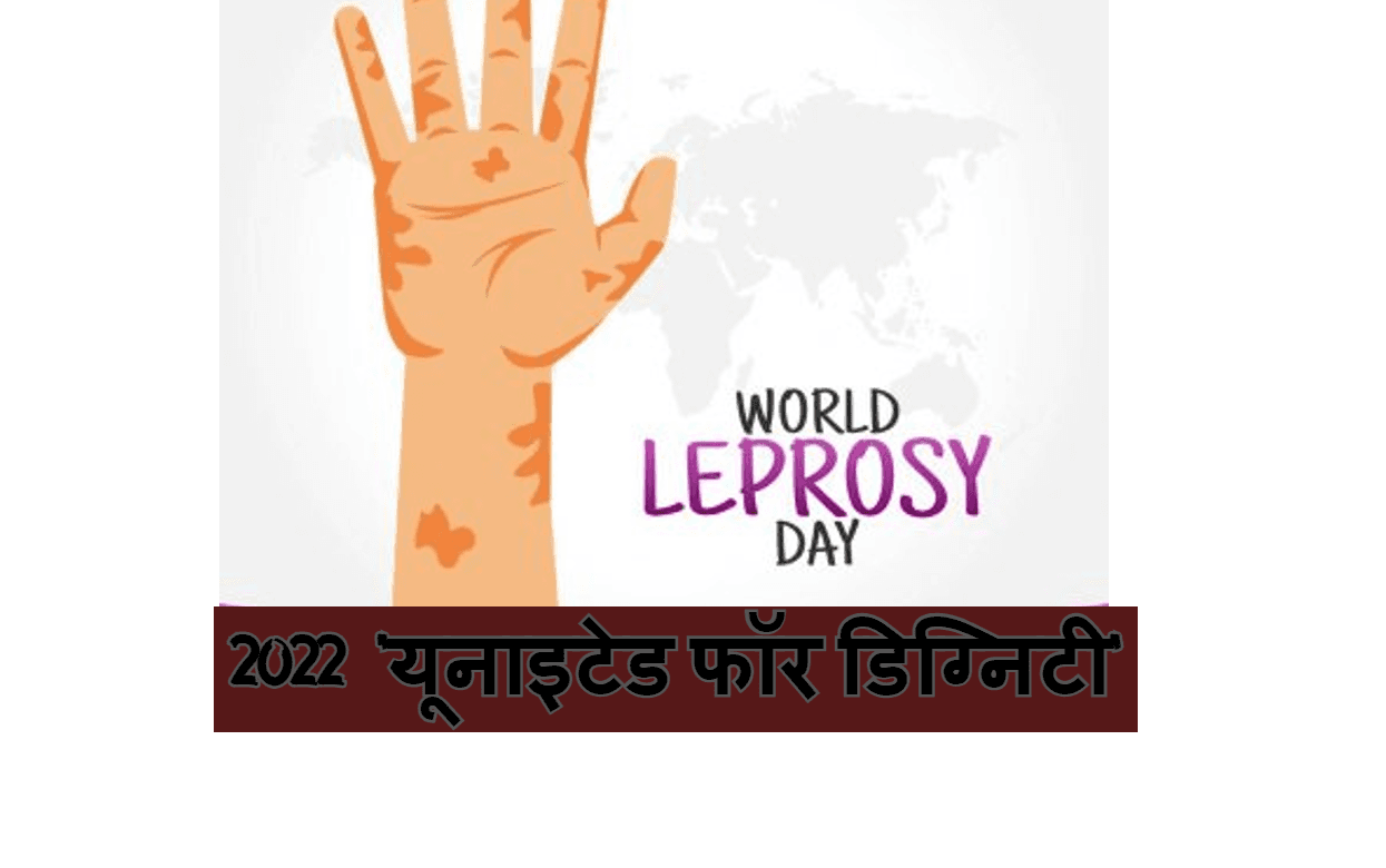 World Leprosy Day 2022: आज है विश्व कुष्ठ दिवस, जानें इस दिन इतिहास, उद्देश्य और इस साल की थीम