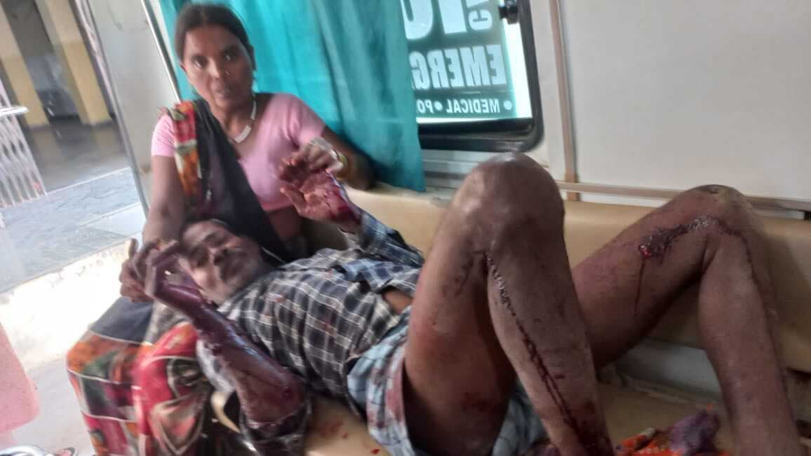 आगरा में लकड़बग्‍घों ने किया गांव वालों पर हमला, एक बच्ची हुई लापता फिर गुस्‍साई भीड़ ने लिया बदला