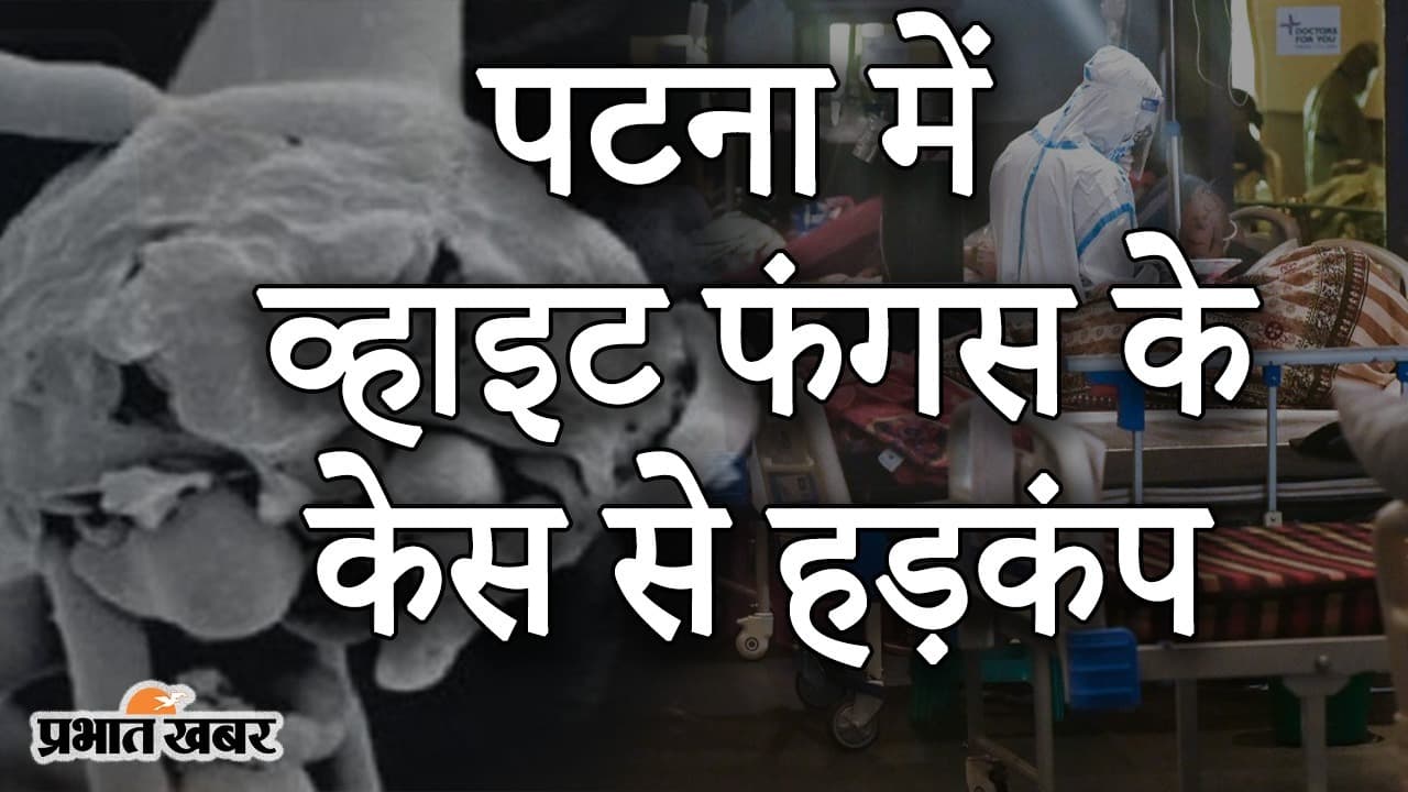 कोरोना संकट के बीच पटना में White Fungus के केस से हड़कंप, ब्लैक फंगस से कितना अलग इसका संक्रमण?