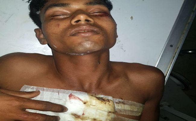 बाइक सवार नकाबपोश अपराधियों ने छात्र को मारी गोली, हालत गंभीर