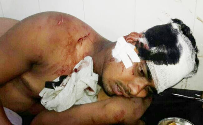 दुमका : नकाबपोश अपराधियों ने व्यवसायी को पत्थर से कूचकर मार डाला, पुत्र को किया घायल