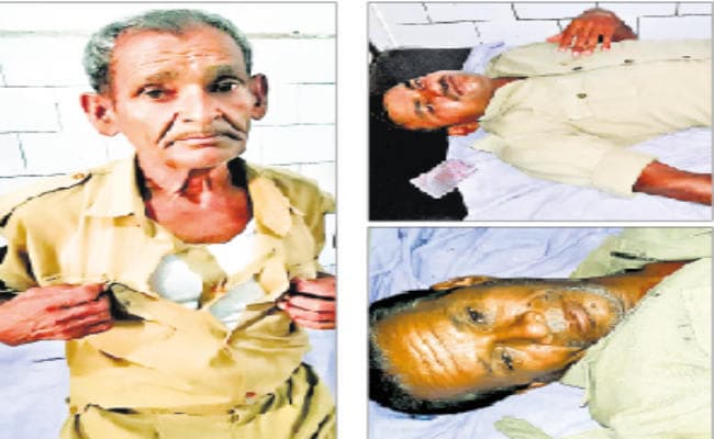 सदर अस्पताल की सुरक्षा में तैनात तीन होमगार्ड की पिटाई