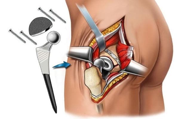 इलाज में लापरवाही पर केंद्र सरकार सख्त : ‘सर्जरी’ में गड़बड़ी पर यहां करें शिकायत