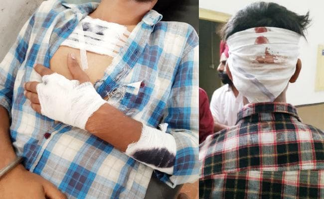 लुधियाना में पंजाबी छात्रों ने दर्जनों बिहारी छात्रों को पीटा, लहूलुहान छात्रों ने CM नीतीश से मांगी मदद