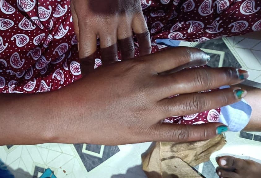 Varanasi News: पुलिस पर अत्याचार के आरोप झूठे, बच्चों की लड़ाई के बाद दो गुटों में पत्थरबाजी