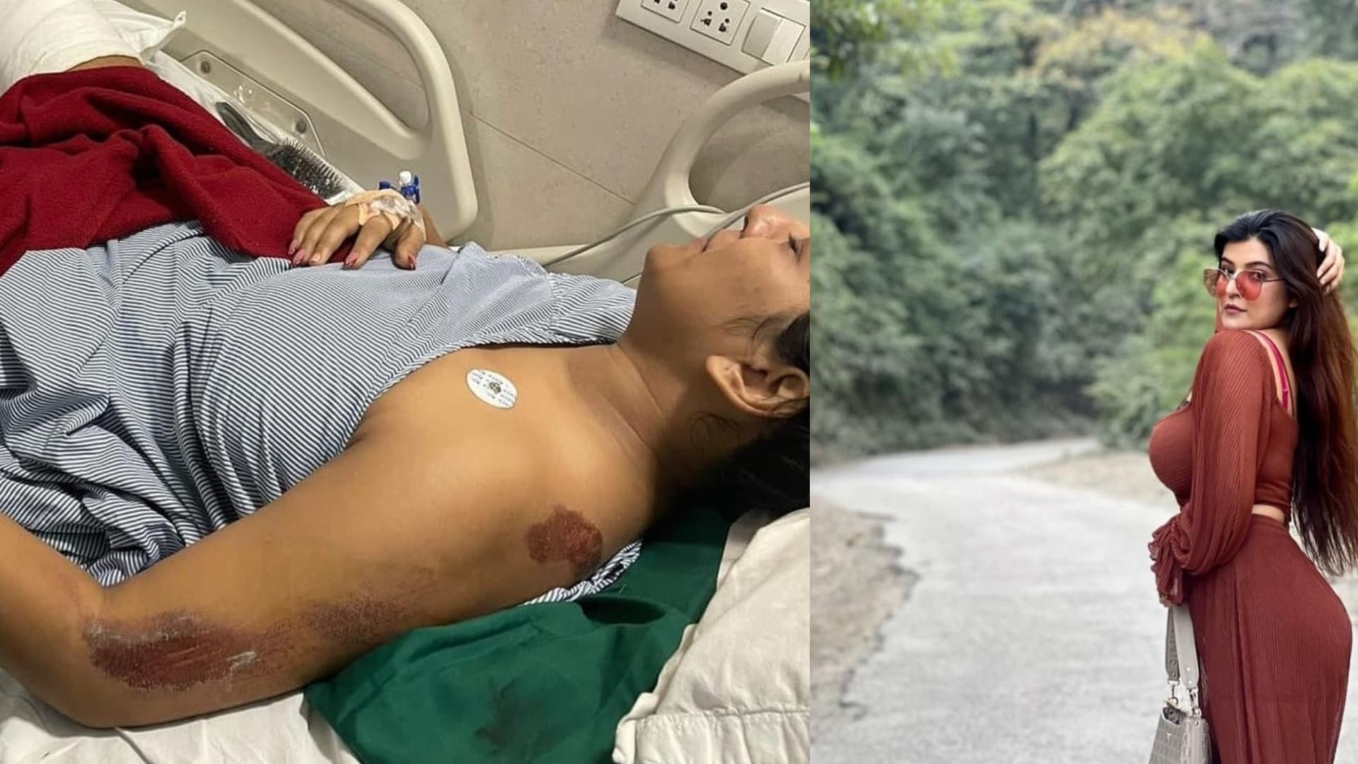 सोशल मीडिया इंफ्लुएंसर प्रिया सिंह को उसके बॉयफ्रेंड ने रेंज रोवर से कुचला, प्रिया के 1.1 मिलियन फॉलोवर्स